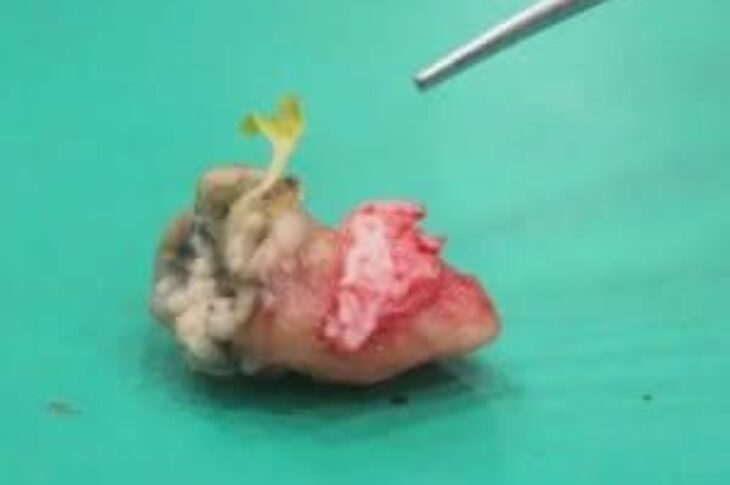 Dente