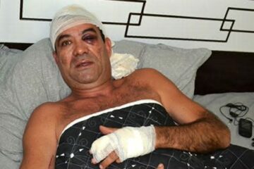 Várias partes do corpo do radialista estão enfaixadas e o olho esquerdo está fechado por conta de um golpe de faca. (Foto: Emanuel Fernandes).