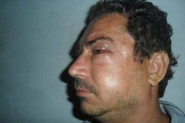 Radialista foi agredido dentro de casa pelo advogado e dois comparsas Arquivo Pessoal