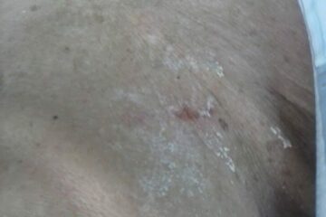 José Miranda Gomes de 73 anos