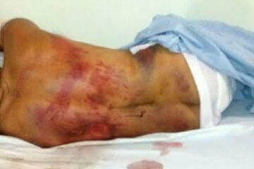 Foto: Reprodução / Notícias de Santa Luz