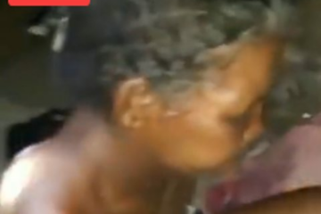 Áurea ficou mais de 16 horas com uma faca cravada nas costas, na madrugada de quinta-feira (3), em Carinhanha.Foto: Reprodução Internet.