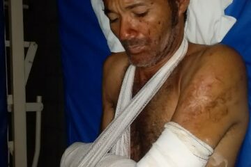 Hélio foi espancado na noite de 27 de janeiro,em Juvenília, no Norte de Minas.Foto:reprodução da família.