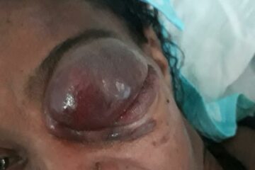 Eva Maria Rocha dos Santos espera há 23 dias por uma consulta,em Vitória da Conquista.