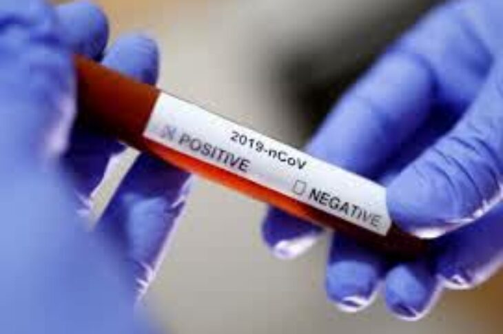 Guanambi realiza testes rápidos em 150 policiais. Foto: ilustrativa.