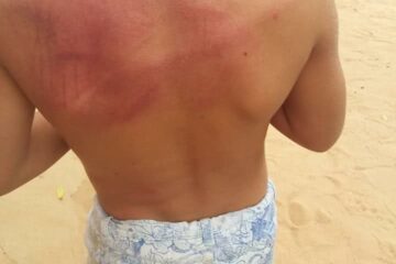 Garoto agredido pela vizinha em Carinhanha. Foto: reprodução Fecebook da Tia.