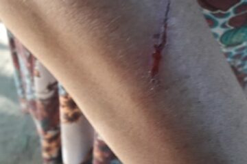 Mulher com transtorno mental é agredida na zona rural de Carinhanha. Foto: Sobrinha da vítima.