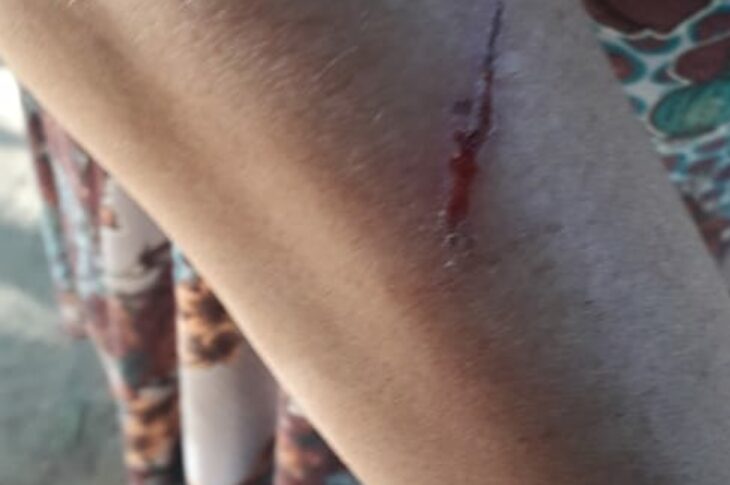 Mulher com transtorno mental é agredida na zona rural de Carinhanha. Foto: Sobrinha da vítima.