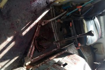 Edmar Balduino da Silva foi golpeado com um facão na tarde de quarta-feira (2), em Palmas de Monte Alto. Foto: Vilson Nunes.