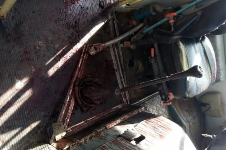 Edmar Balduino da Silva foi golpeado com um facão na tarde de quarta-feira (2), em Palmas de Monte Alto. Foto: Vilson Nunes.