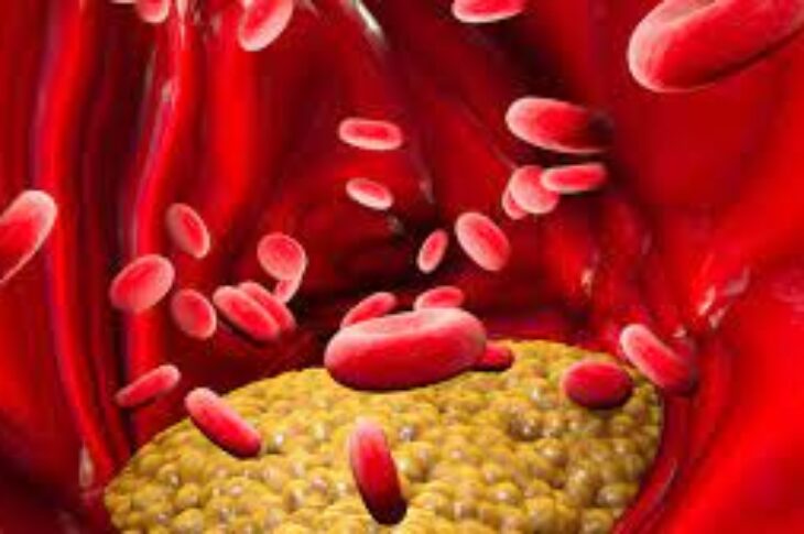 Triglicerídeos: Foto: reprodução altadiagnosticos.com.br