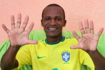 Josevaldo mostra mãos com seis dedos cada (Foto: Raimundo Mascarenhas / site Calila Notícias)