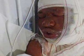 Fábio foi espancado e queimado.. Foto: Foto: Reprodução