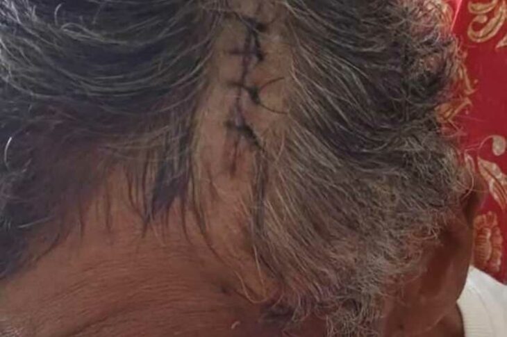 Idoso espancado em Caetité. Foto: Reprodução Achei Sudoeste