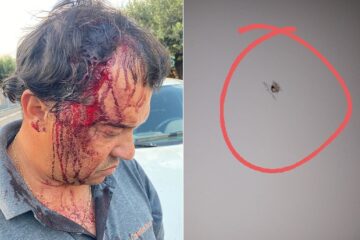 Kio após ser agredido