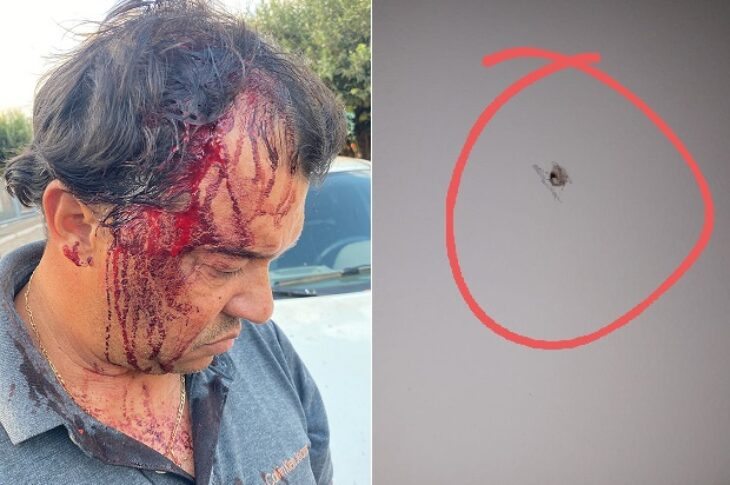 Kio após ser agredido