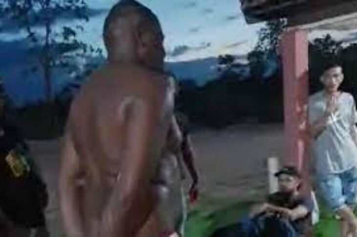 Vítima de espancamento