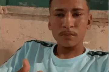 Maike teve mais de 80% queimado. Foto: rede social