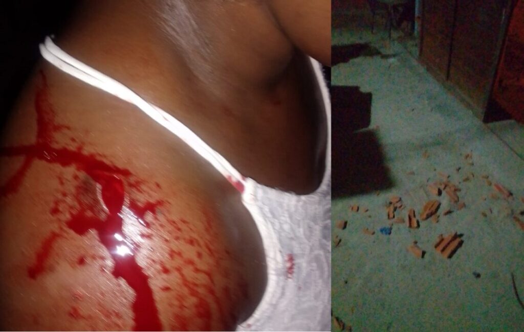 Vítima de agressão em Malhada. Foto: Enviada pela vítima
