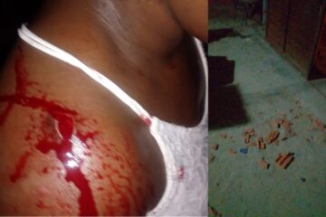 Vítima de agressão em Malhada. Foto: Enviada pela vítima