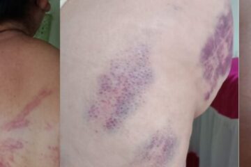 Idosa é tortura e agredida