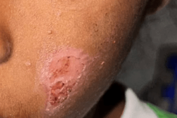 Criança agredida em Barra. Foto: reprodução rede social.