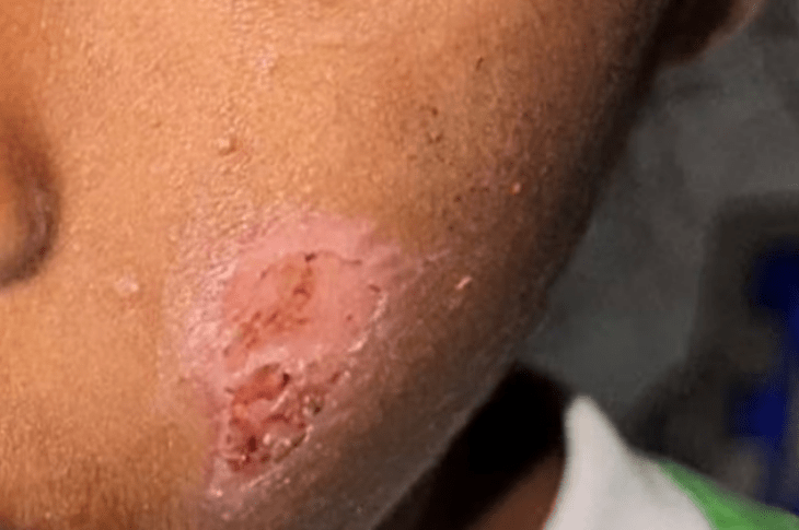 Criança agredida em Barra. Foto: reprodução rede social.