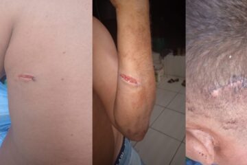 Cleiton ferido após a confusão. Foto: encaminhada por Cleiton