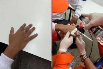 Adolescente com anel preso no dedo. Foto: 20º Bombeiros