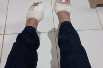 Pés do vereador Ubiratam da Saúde.