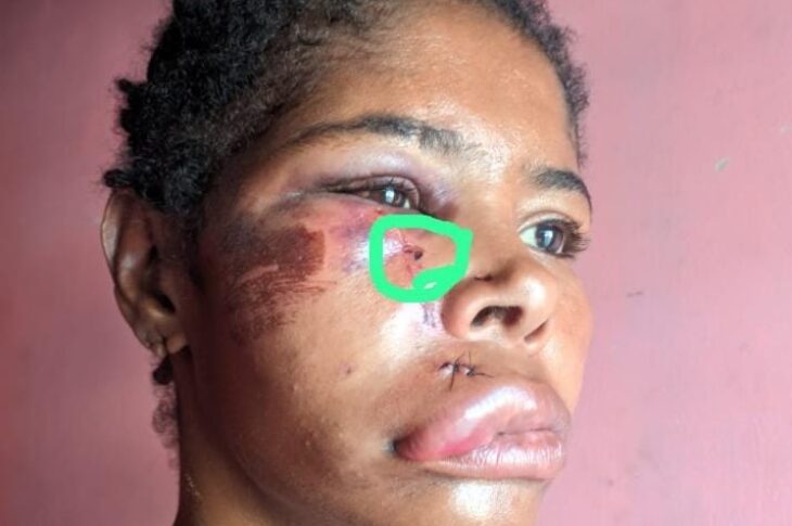 Quita denuncia que foi agredida por policiais. Foto: reprodução