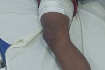 Discussão termina em disparos de carabina e deixa dois feridos em Pindorama